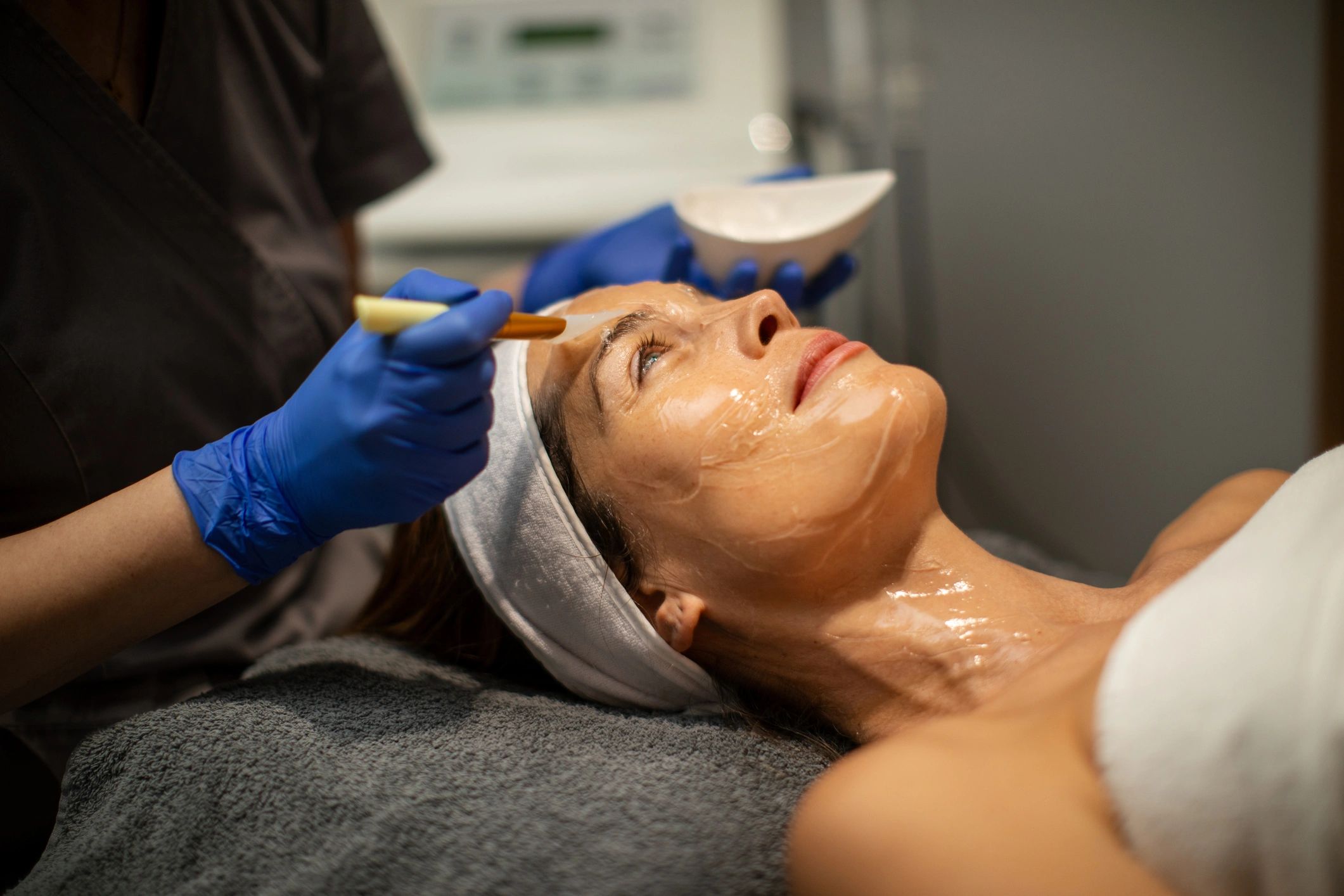 Chemical Peels Decoded: Choosing the Right Peel